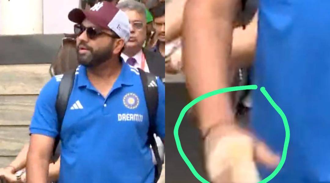 [Watch] Is Rohit Sharma Playing 2023 World Cup With A Finger Injury?